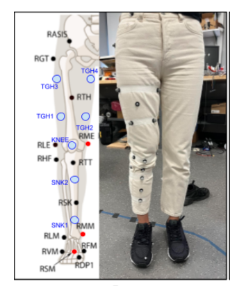 Soft Exosuit for Ambulatory Patients with Spinal Muscular Atrophy (SMA), United States, $4000